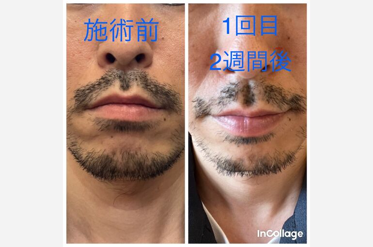 incollage_save